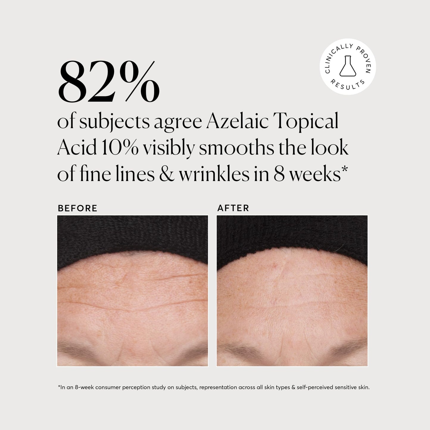Naturium Ácido tópico azelaico 10%, con niacinamida y vitamina C, tratamiento facial, removedor de manchas oscuras, 1 onza (30 ml), sin fragancia, sin alcohol, para todos los tipos de piel, 1 onza