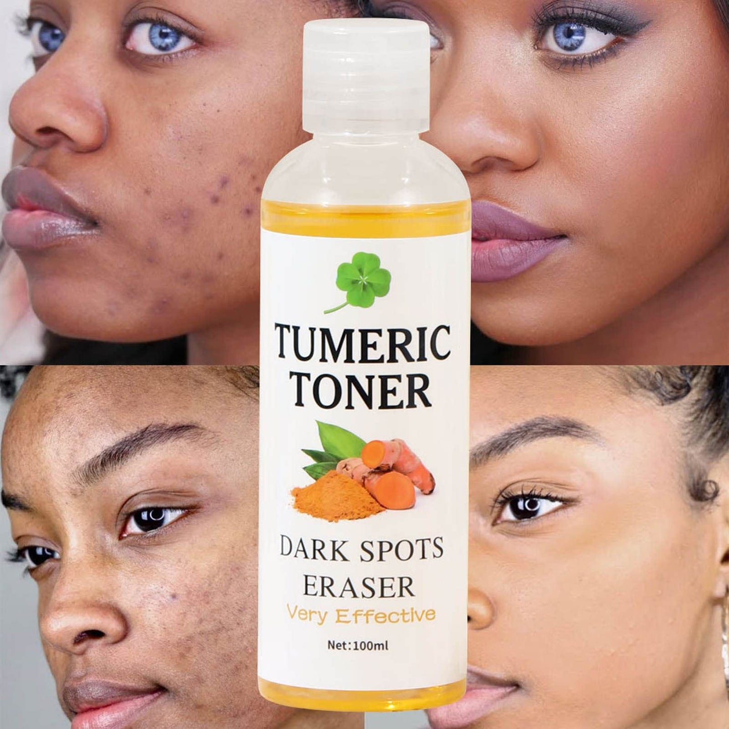 Crema diaria para la piel con cúrcuma y eliminador de manchas negras, 100 ml