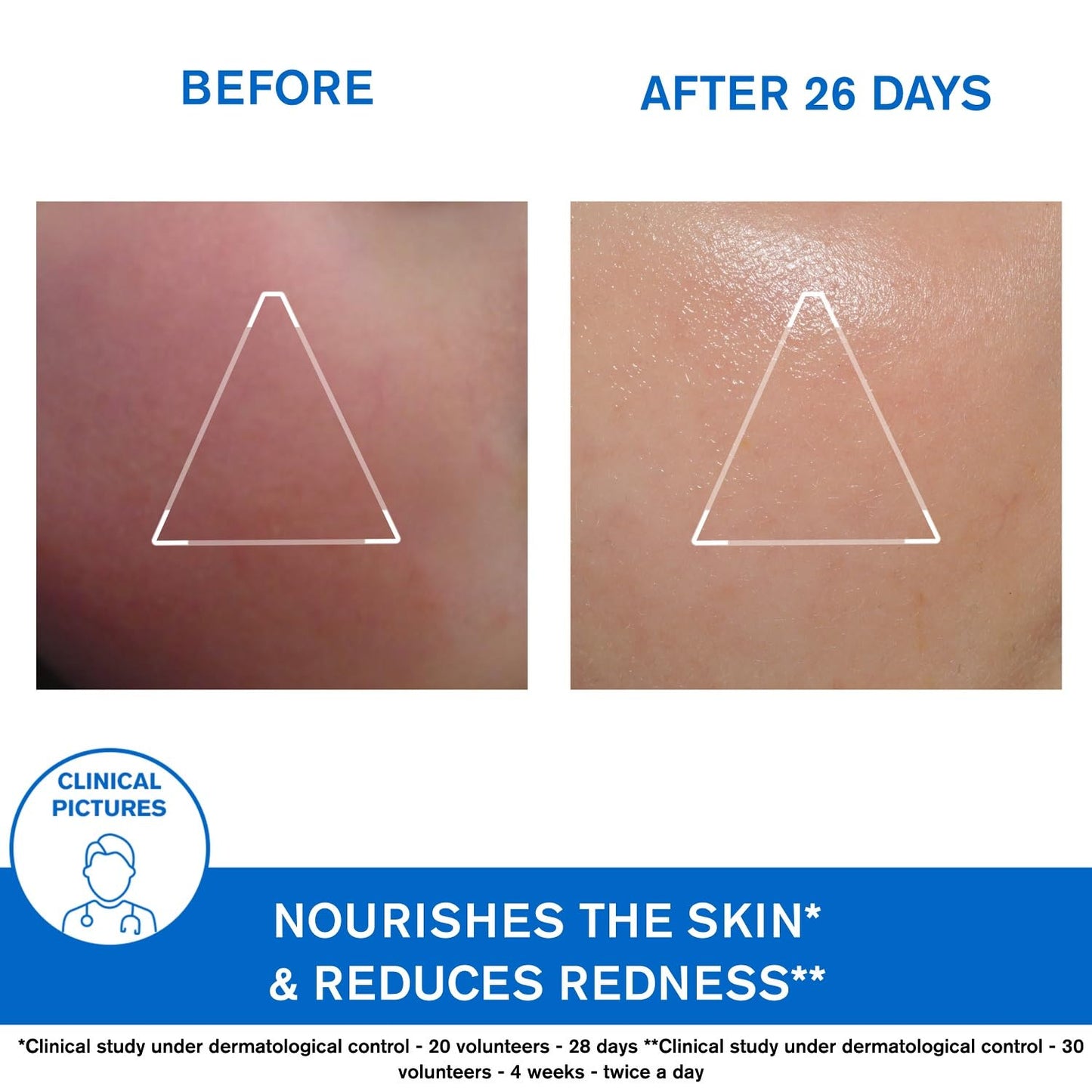 Uriage X?mose Face Cream 40ml by Uriage
