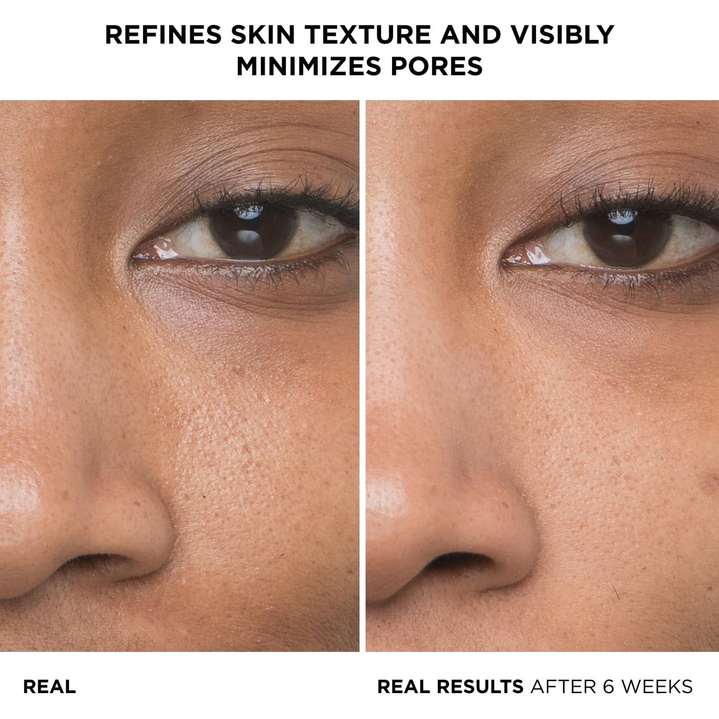 It Cosmetics Bye bye Pores, Serum, Suero Facial con Ácido Glicólico al 10% Minimiza los Poros en 1 Semana y Exfolia Suavemente y Refina la Textura de la Piel con Ácido Hialurónico, 30 ml