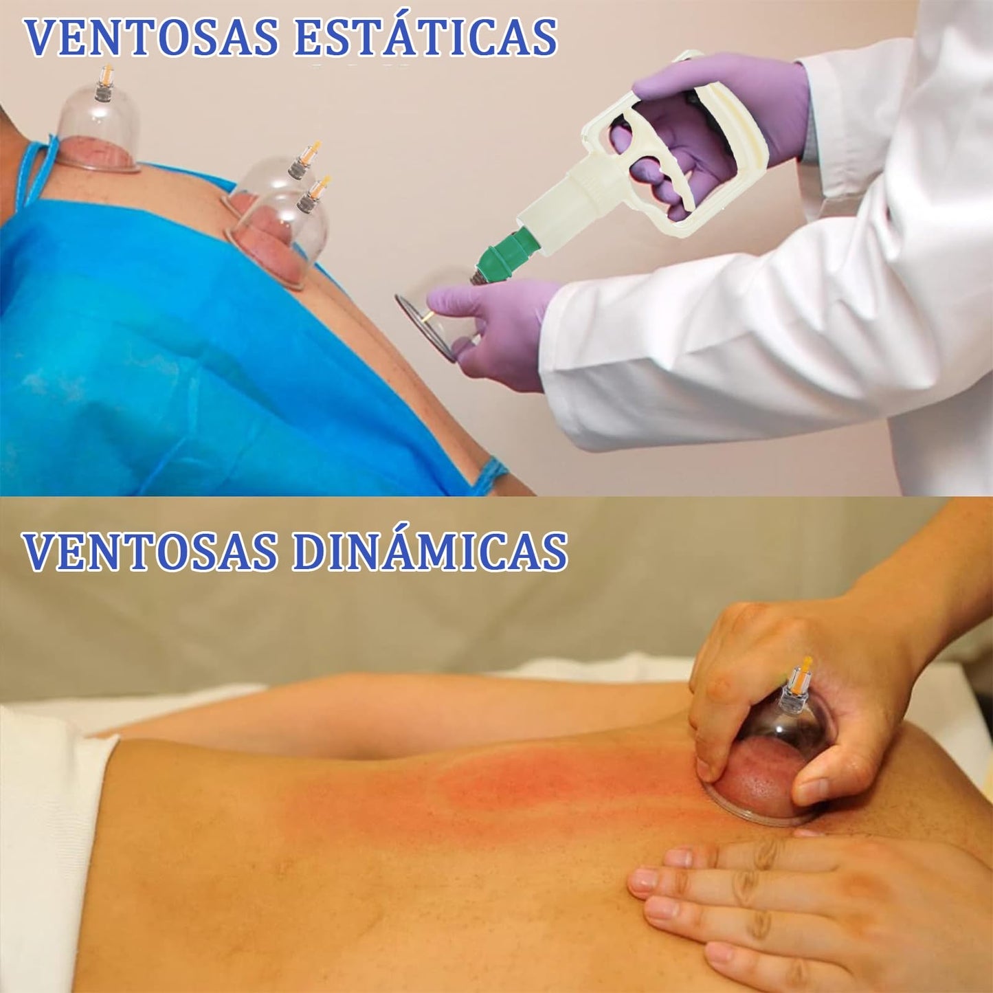 Juego de terapia de ventosas, juego de ventosas de 32 piezas, kit de ventosas profesional con tabla Gua Sha y ventosa de aceite Gua Sha, ventosa con bomba para aliviar la celulitis