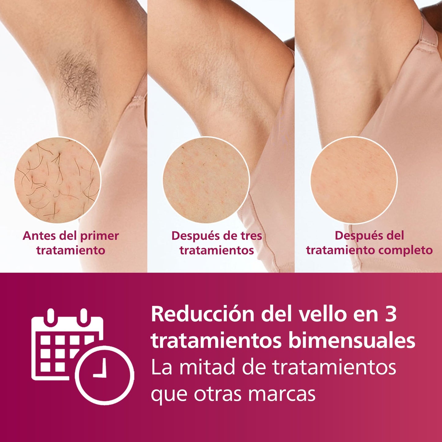 Depiladora Luz Pulsada IPL Philips Lumea Series 7000 Blanco con Lápiz Recortador Compacto y 3 Accesorios para Cuerpo, Cara y Bikini