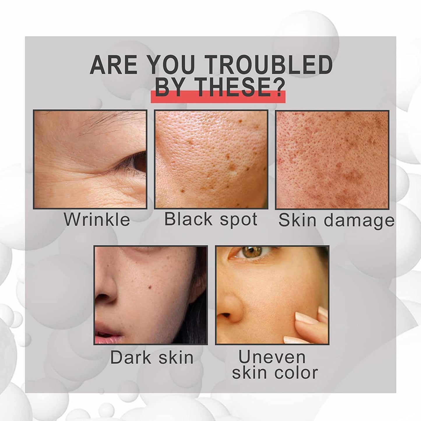 Esencia Voletas Collagen Boost Suero antienvejecimiento Colágeno Suero antiarrugas Suero corrector de manchas en la piel Suero reparador de hidratación profunda Esencia de suero facial Cuidado de la piel (A)