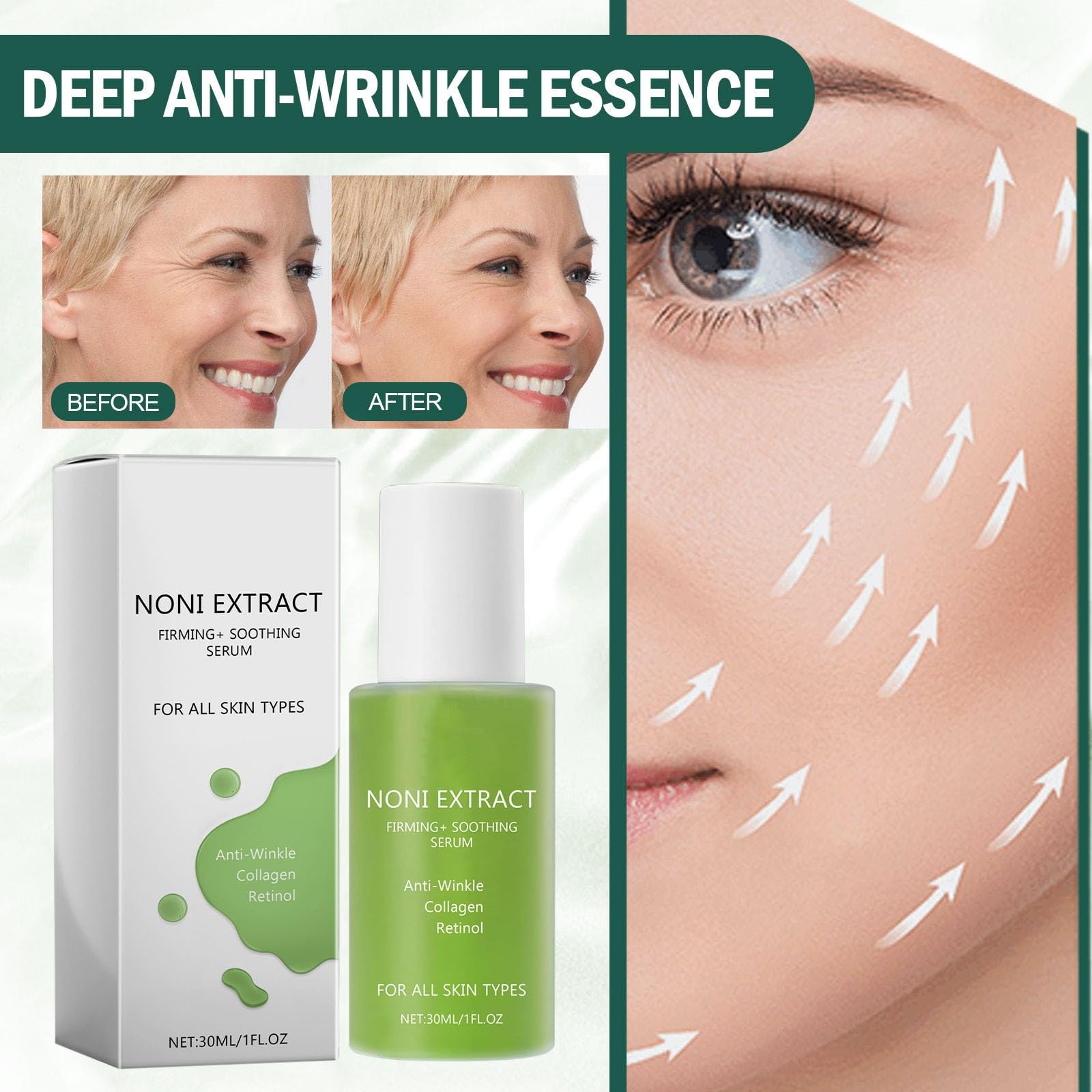 Serum Facial de Extracto de Noni para Rejuvenecer y Suavizar la Piel - Pack de 3, 30ml