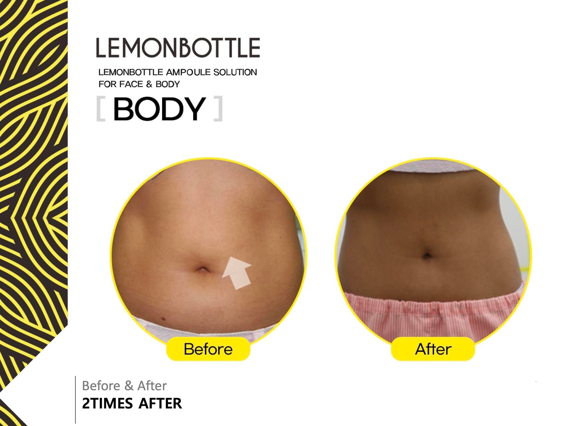 Lemon bottle solución de ampolla | 5 viales de 0.3 fl oz | Dispendiente de grasa | Suero cosmético