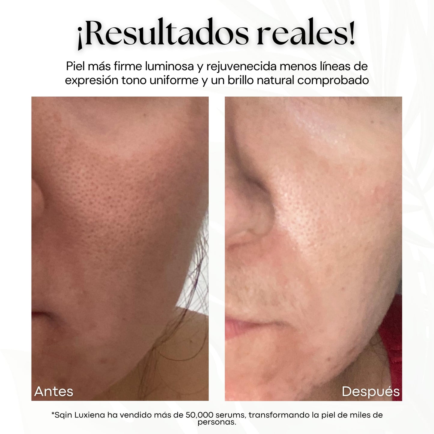 Sqin Luxiena Kit de Cuidado Facial Coreano con 5 Serums + Oil Roller: Vitamina C, Retinol, Ácido Hialurónico, Niacinamida y Baba de Caracol. Hidratación Profunda, Antiarrugas, Antimanchas, Mejora la textura y Luminosidad. Skincare Coreano