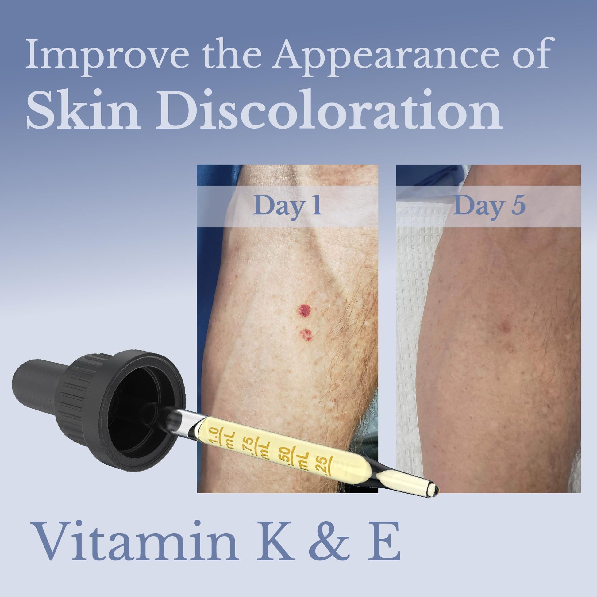 Aceite de Árnica ZENON LIFE Vitamina K Ultraconcentrada para Hematomas