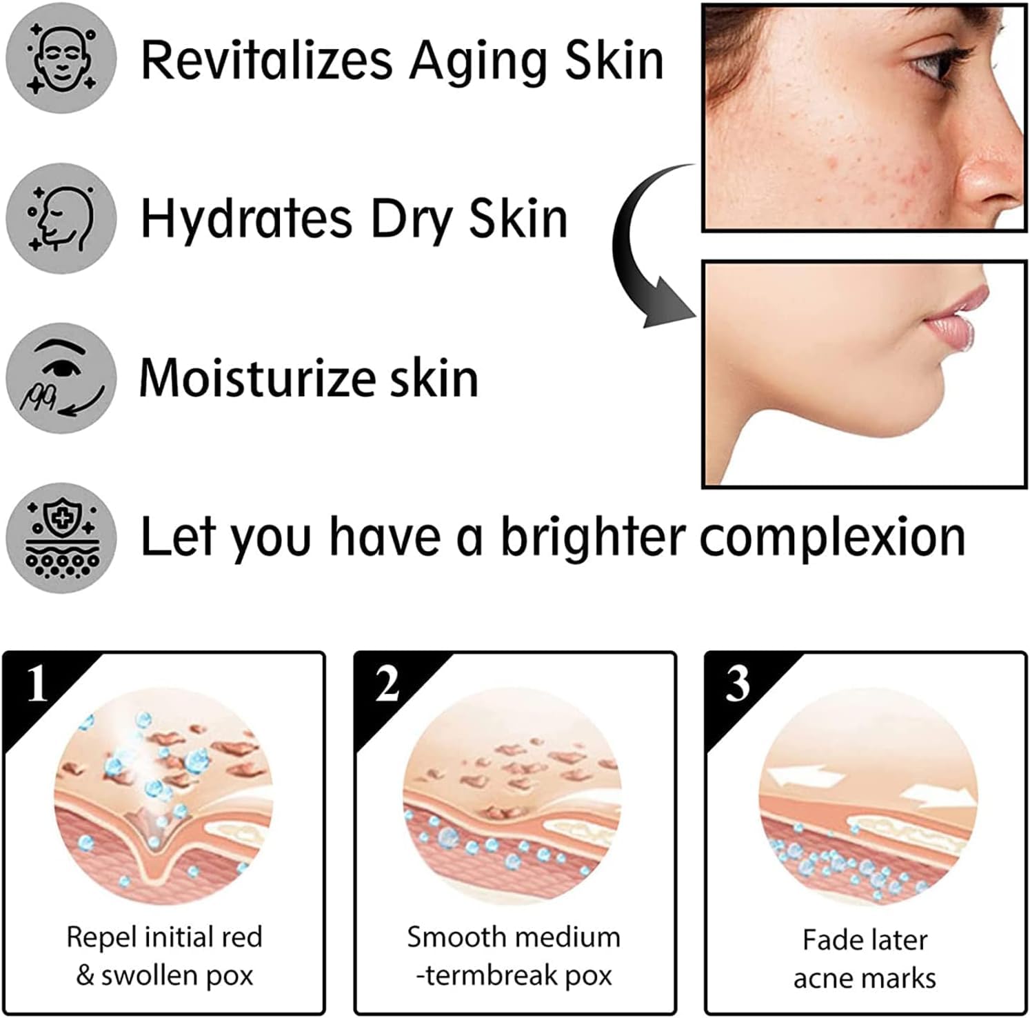 Fórmula Avanzada de Crema Hidratante de Mucina de Caracol para Mujeres - Hidratante Facial Diario 100g (2 Frascos)