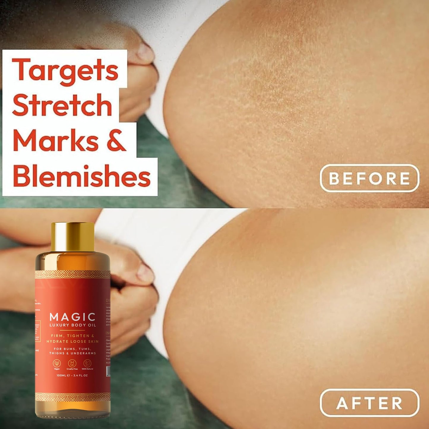 Besque Magic Body Oil - 100ml, Besque Firming Oil, Besque Magic Luxury Body Oil Moisturizer, Multi-Purpose Body Oil for Arms, Chest, Thighs and Tums (2)