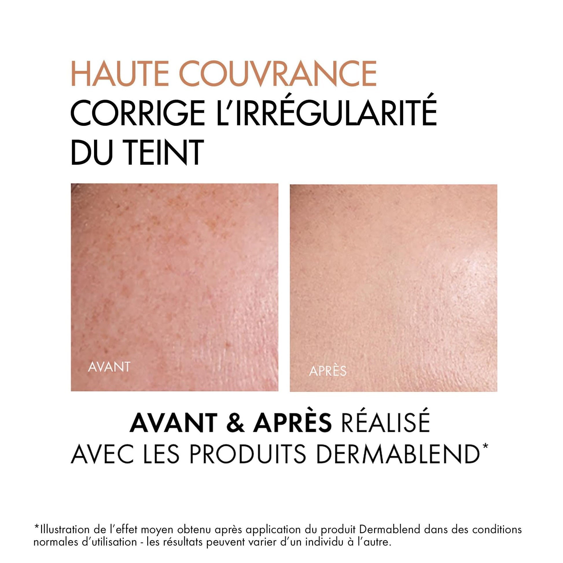 Vichy Dermablend smooth 35 sand 30ml base de maquillaje fluida de alta cobertura 35 SAND