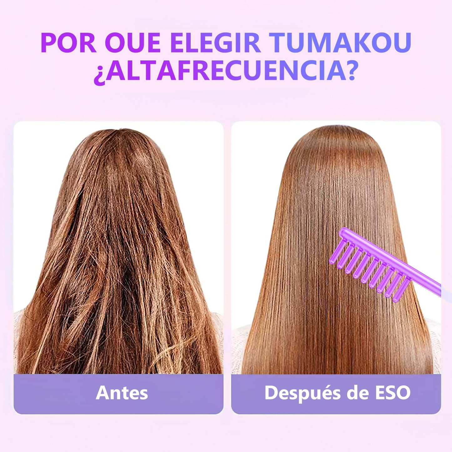 Alta Frecuencia Facial,Radiofrecuencia Facial Corporal de Portátil Con 4 Varitas de Neón Diferentes,Estiramiento de la Piel,Antienvejecimiento,Reducción de Arrugas/Ojeras/Imperfecciones (Luz Violeta)