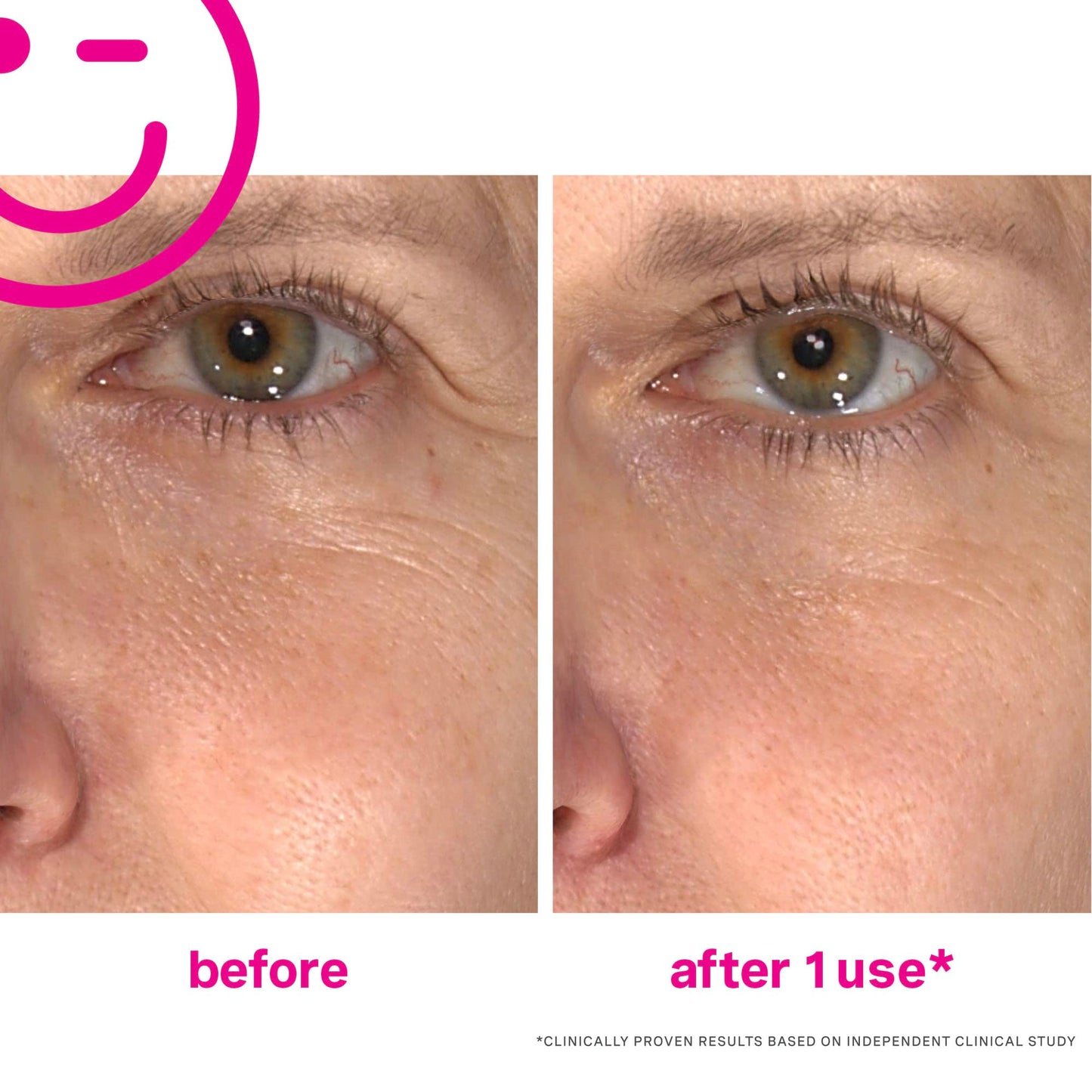 Kate Somerville Wrinkle Warrior - Anti-Wrinkle Treatment - Anti-Aging Solution