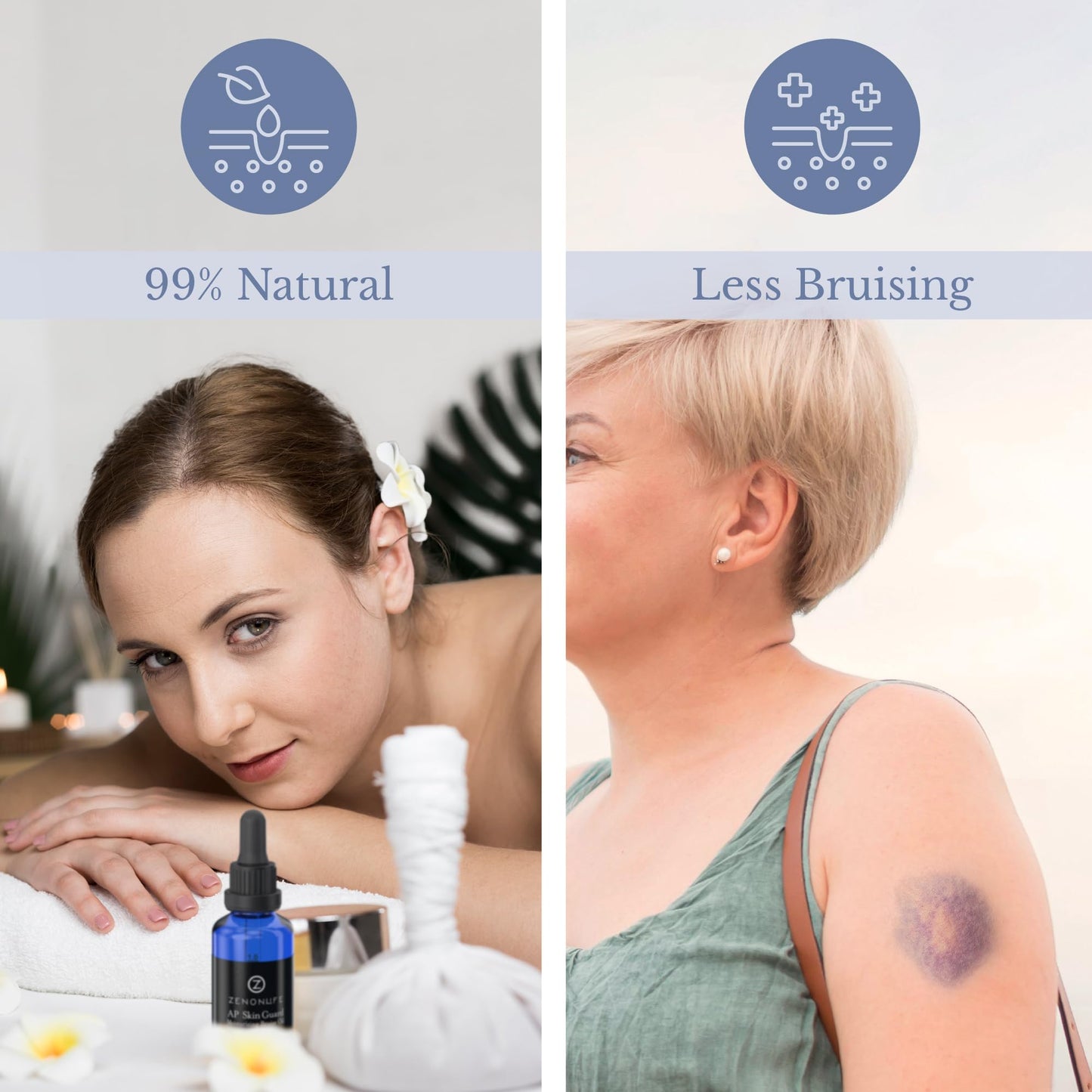 ZENON LIFE- Aceite de árnica para hematomas, vitamina K ultraconcentrada; alternativa de aplicación deslizante y no pegajosa a la crema para hematomas.