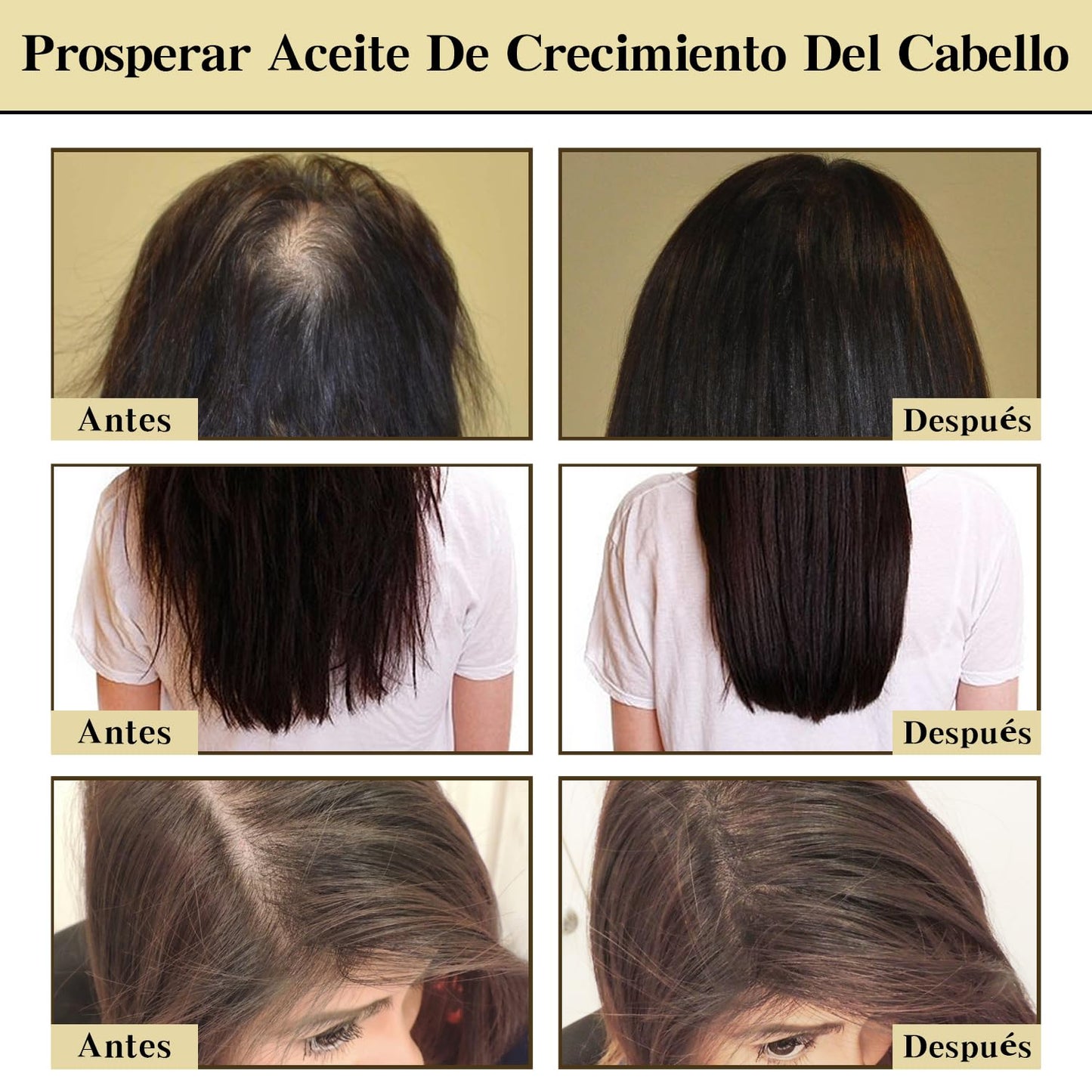 Conjunto Orgánico de Aceite de Romero para el Crecimiento del Cabello - Reducción de la Caída y Protección de la Salud Capilar. Tratamiento Natural para Estimular el Crecimiento y Fortalecer el Pelo. ¡Atrévete a Lucir una Melena Sana y Radiante!