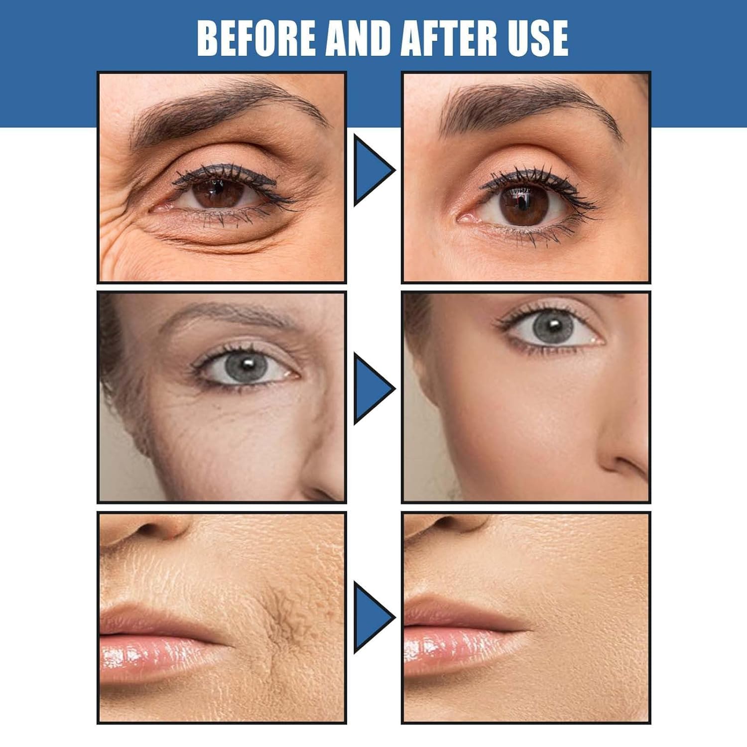 Crema Antiarrugas Con Retinol en 5 Segundos,Crema Facial Antiarrugas,Removedor Instantáneo de Arrugas,Crema Facial Hidratante Lifting,Crema Facial Reafirmante o Para Mujeres