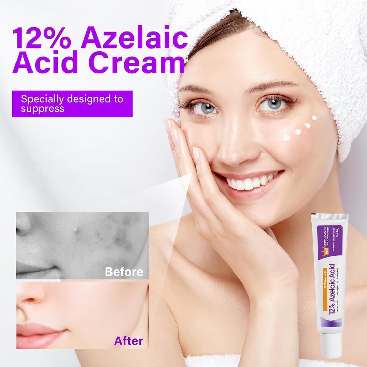 Suero Ácido Azelaico, Crema Ácido Azelaico, Suero Facial Ácido Azelaico 12% Contra Rojeces, Anti Granos y Nódulos, Suero Facial Ácido Azelaico Ácido Hialurónico para Piel Sensible, 20g (3)