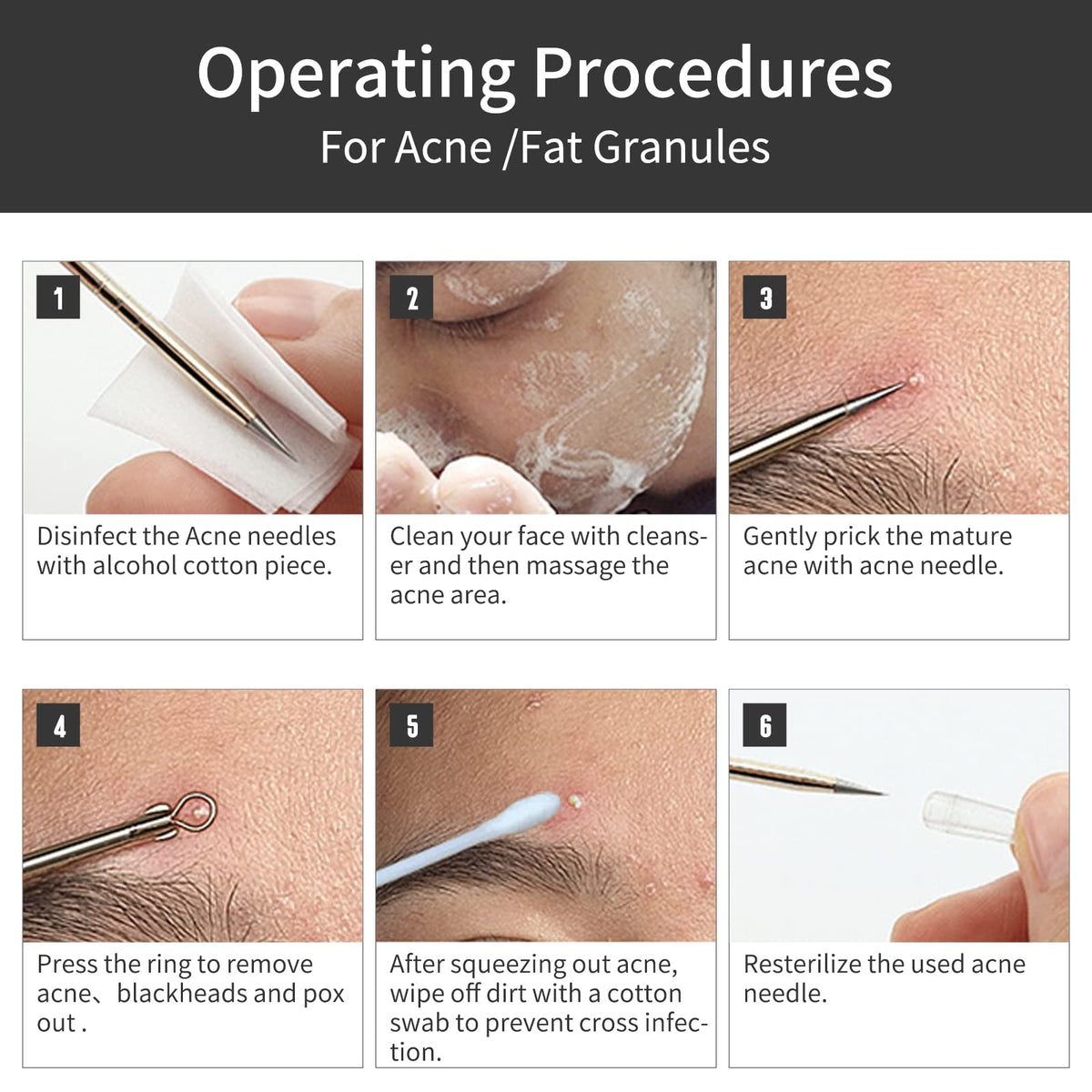 Herramientas para quitar puntos negros, 8 piezas de agujas para acné, GERY Whitehead removedor de espinillas, kit profesional de limpieza de espinillas y poros con paquete de cuero