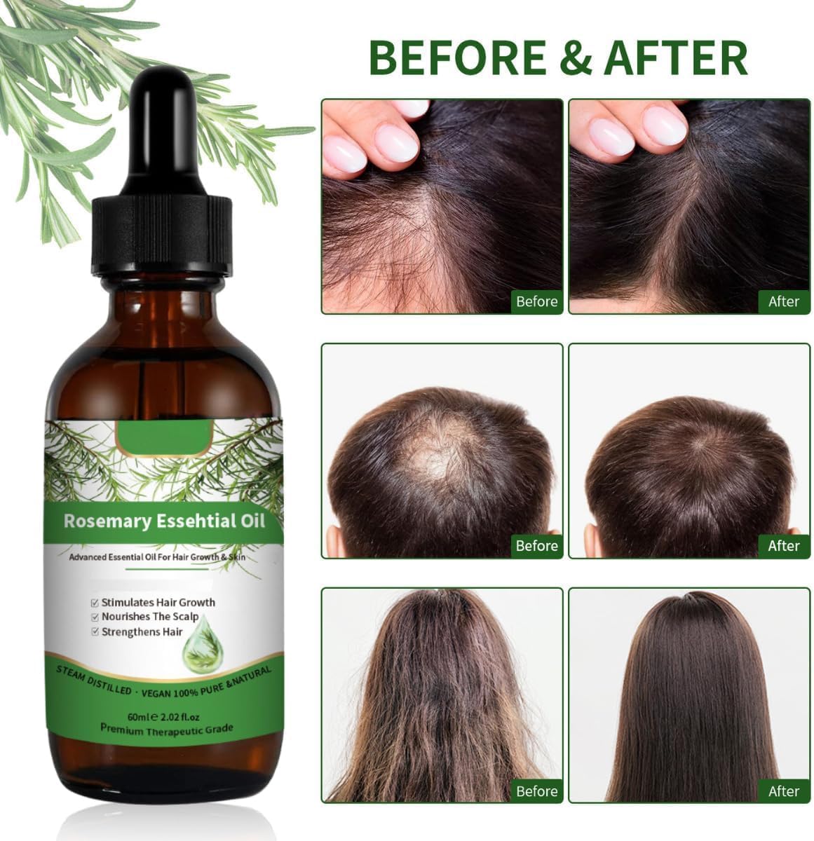 Aceite Esencial Rosemary Cuidado Cabello y Piel Crecimiento Aromaterapia 30 ml