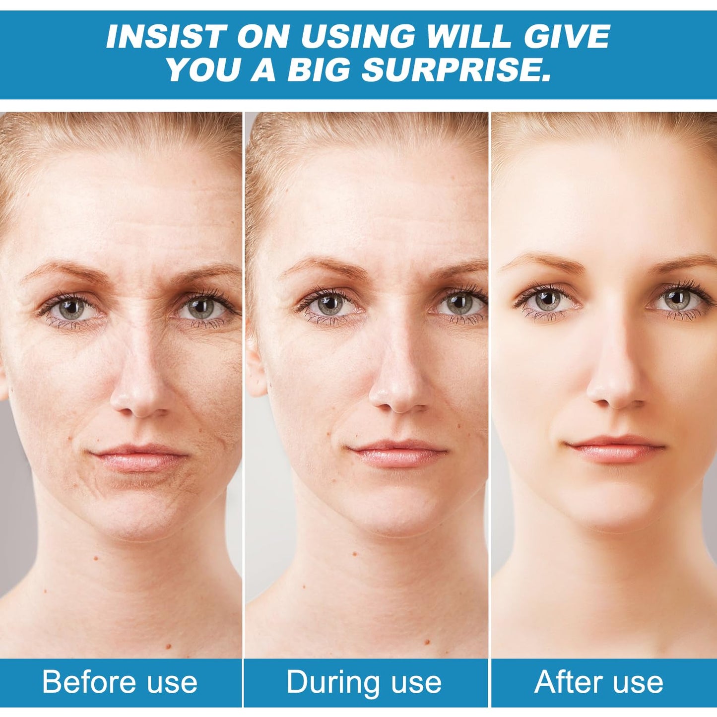 Sistema de microinfusión para labios, sistema micro para rostro, suero facial para piel suave y delicada para todo tipo de piel (1 herramienta de microsistema + 4 sueros faciales)