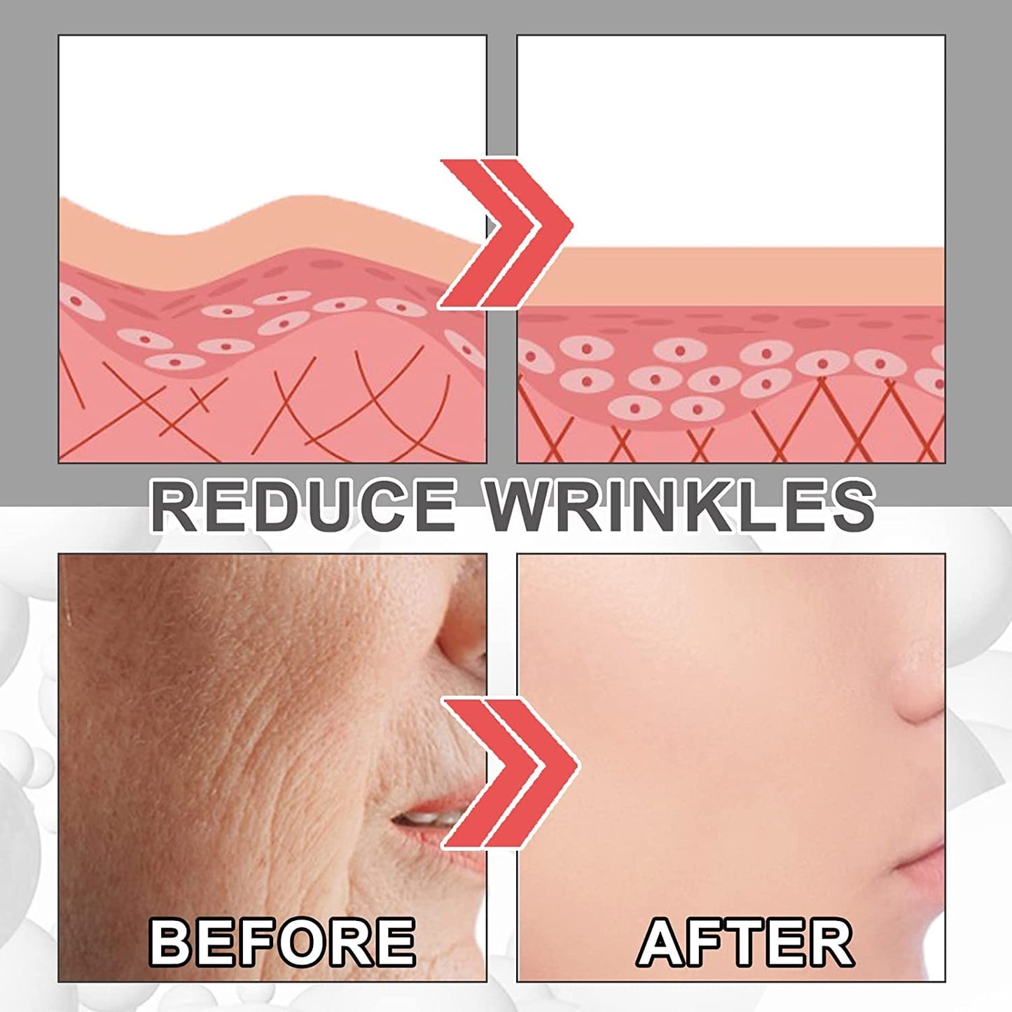 Esencia Voletas Collagen Boost Suero antienvejecimiento Colágeno Suero antiarrugas Suero corrector de manchas en la piel Suero reparador de hidratación profunda Esencia de suero facial Cuidado de la piel (A)
