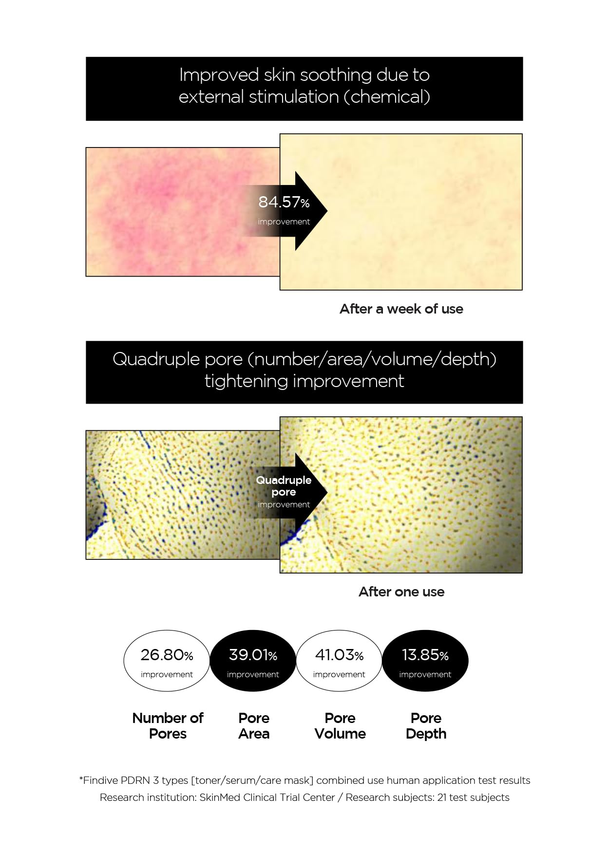 Suero de Exosomas PDRN CICA 1% con Colágeno Marino para Piel Suave y Regenerada