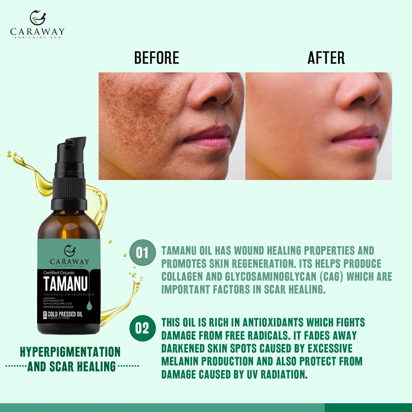 CARAWAY Tamanu Oil Organic for Skin – Ayurvedic Extraction Method Helps Treat Psoriasis, Eczema, Acne Scar, Rosacea – 1.7 Fl oz – 50 ml – Indian Origin