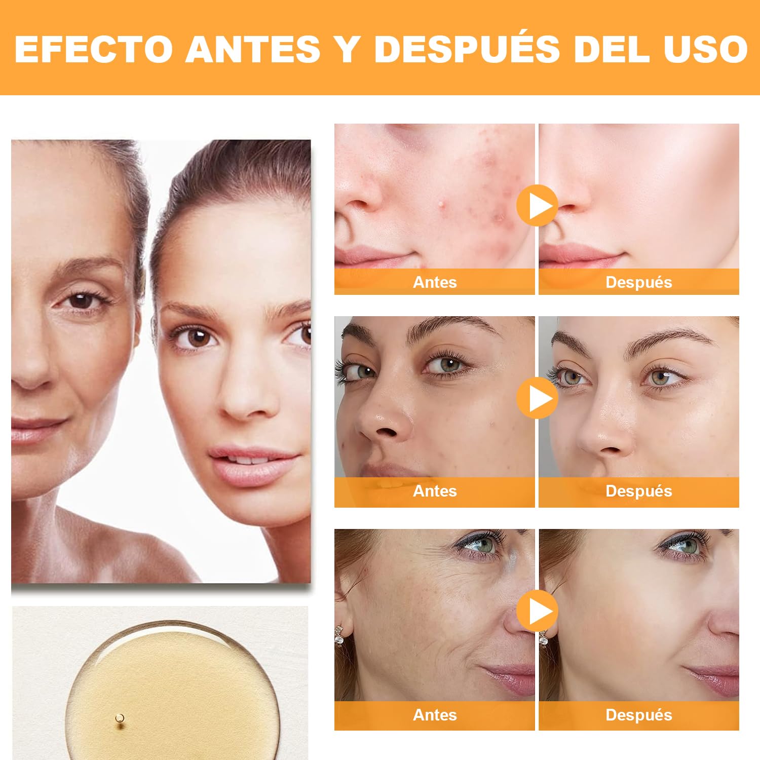 Solución de Ácido Glicólico al 7% para Rejuvenecimiento y Tonificación de la Piel - 240ML - Tratamiento Antimanchas y Antiacné