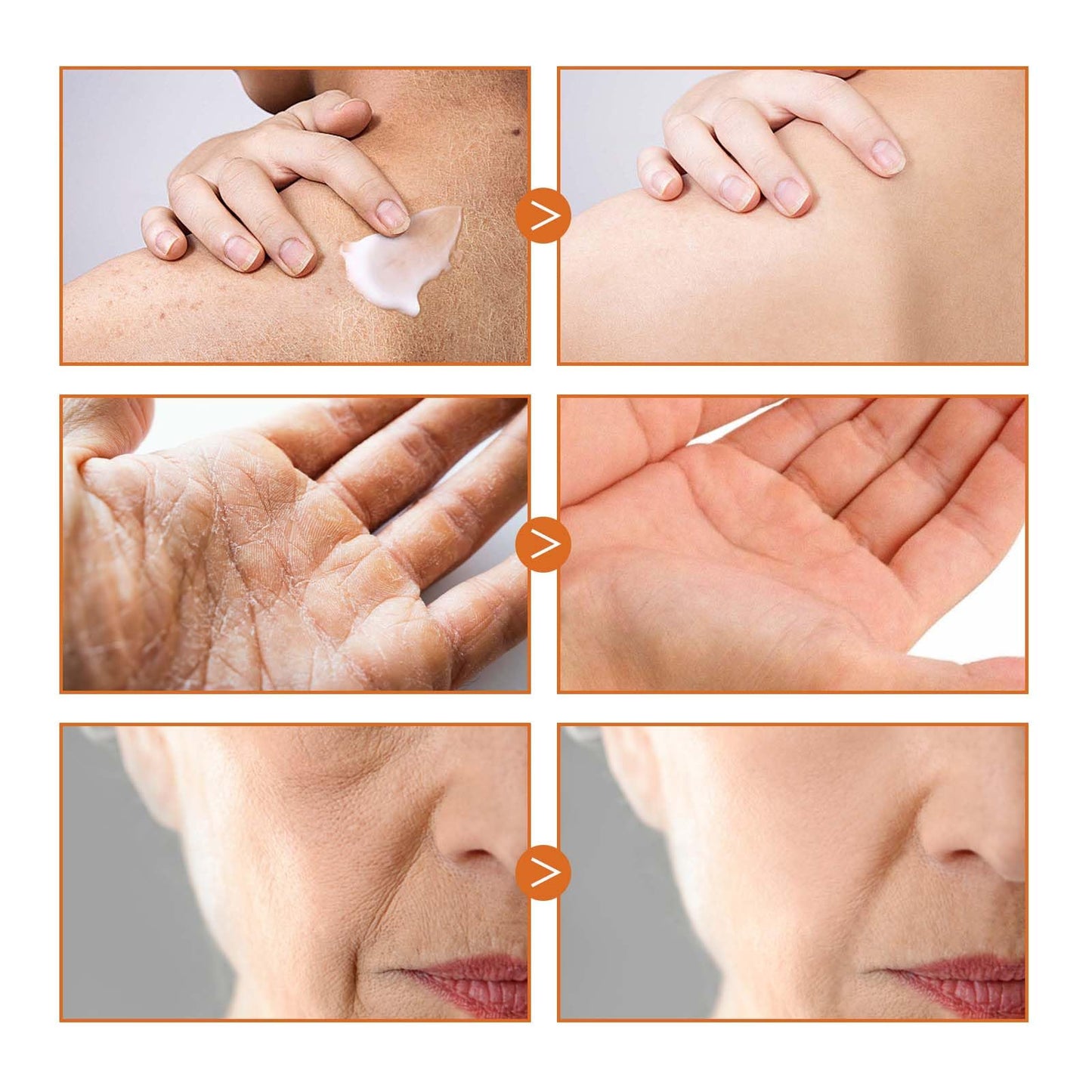 Crema Facial De Sebo De Res, BáLsamo De Sebo OrgáNico Y Miel, BáLsamo De Sebo Para El Cuidado Hidratante De La Piel Corporal (120G)
