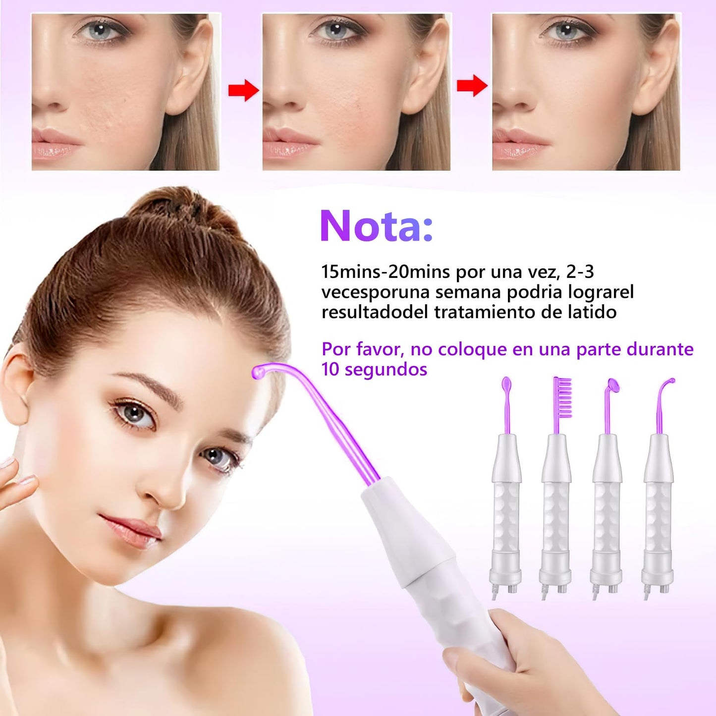 Alta Frecuencia Facial,Radiofrecuencia Facial Corporal de Portátil Con 4 Varitas de Neón Diferentes,Estiramiento de la Piel,Antienvejecimiento,Reducción de Arrugas/Ojeras/Imperfecciones (Luz Violeta)