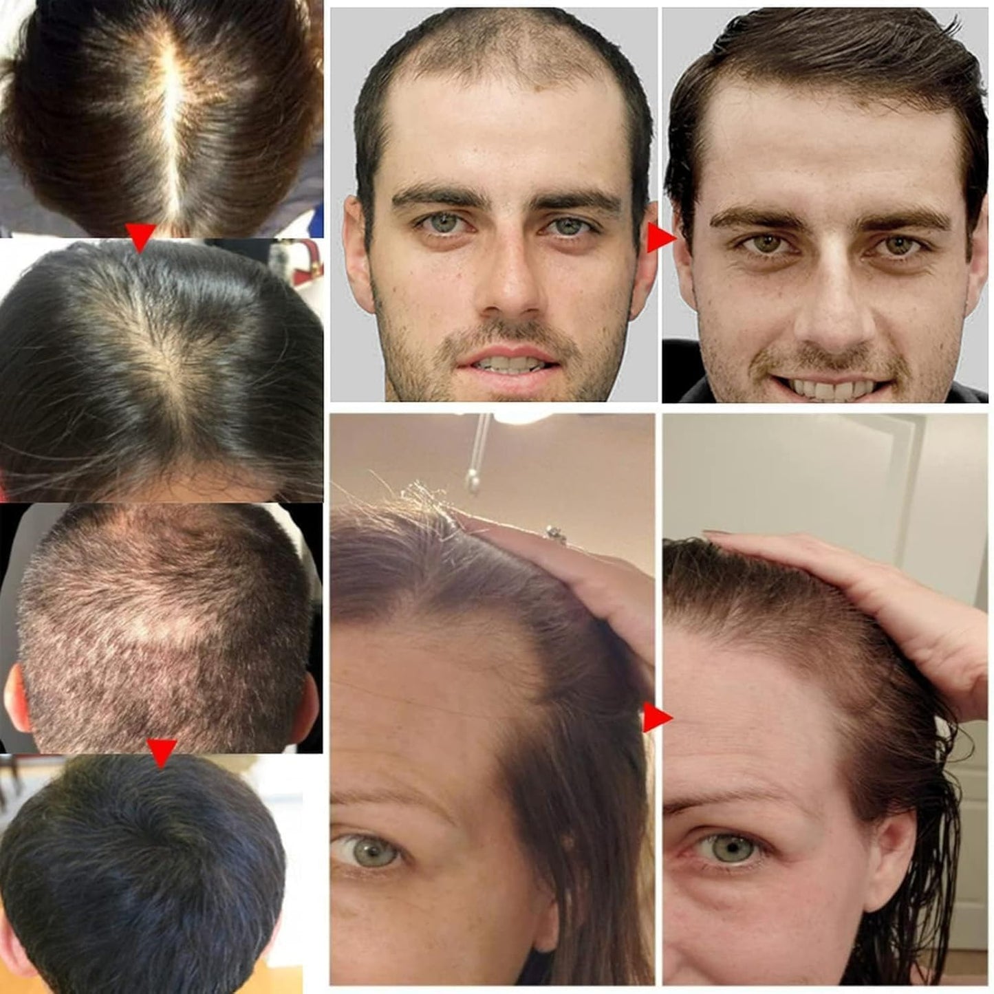 Aceite Esencial Rosemary Cuidado Cabello y Piel Crecimiento Aromaterapia 30 ml