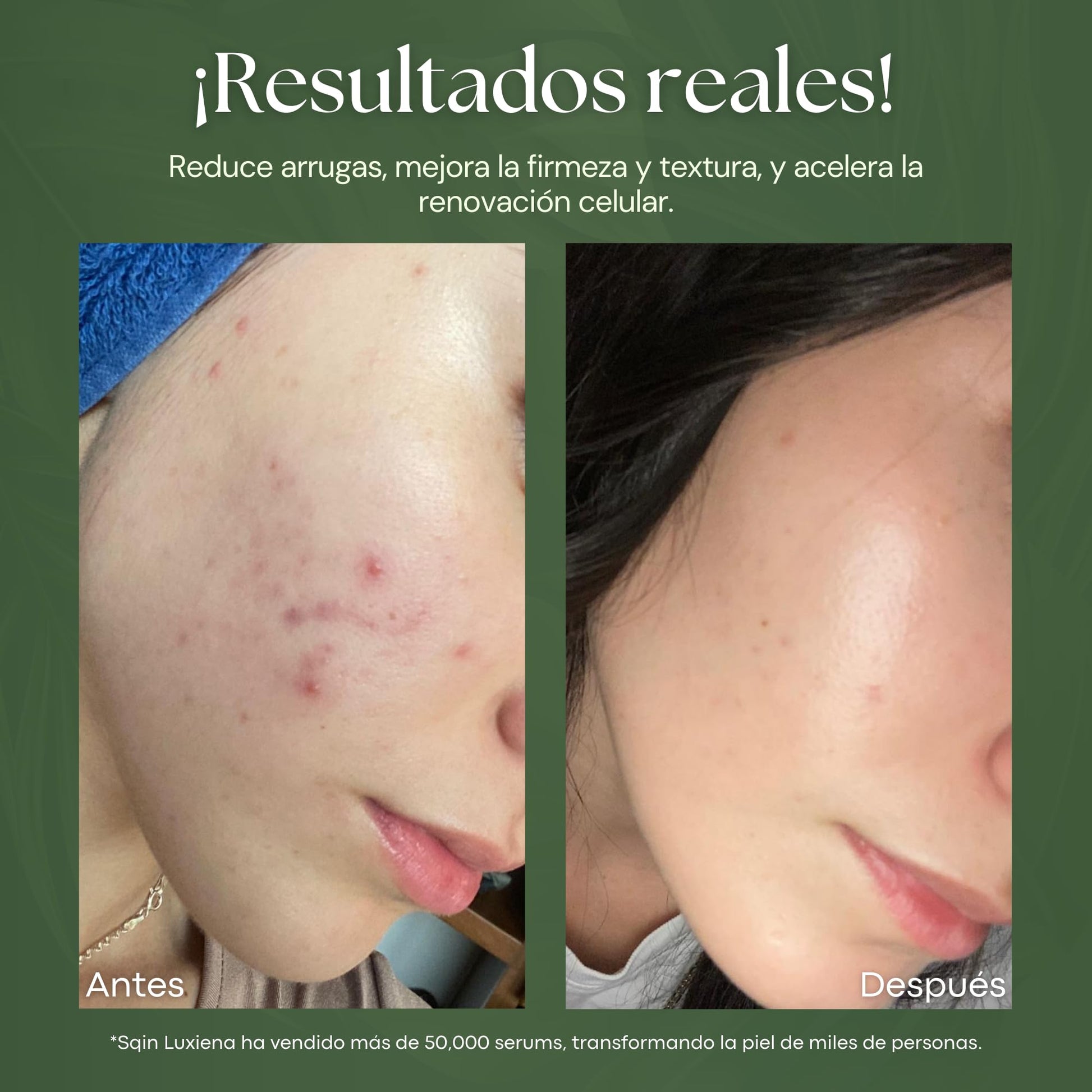 Sqin Luxiena Korean Serum Retinol 0.15%, Niacinamida y Vitamina E Facial. Suero Nocturno Antiarrugas + Anti Manchas. Serum de noche para signos de envejecimiento avanzados. 100% Skincare Coreano Vegano 32 ml.