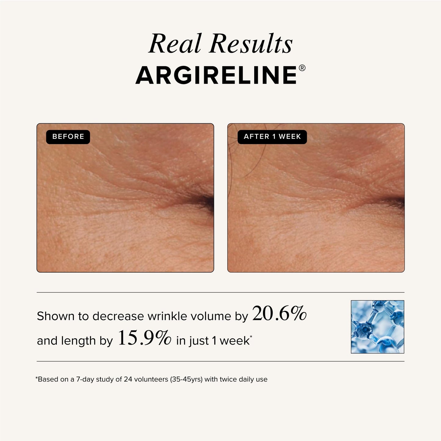 MATRIXYL 3000 + ARGIRELINE Peptide + Vitamin C 4 oz Serum with Organic Hyaluronic Acid - Reduce Sun Spots, Wrinkles, Our Most Powerful Triple Combination - ASTERWOOD NATURALS - Bottle