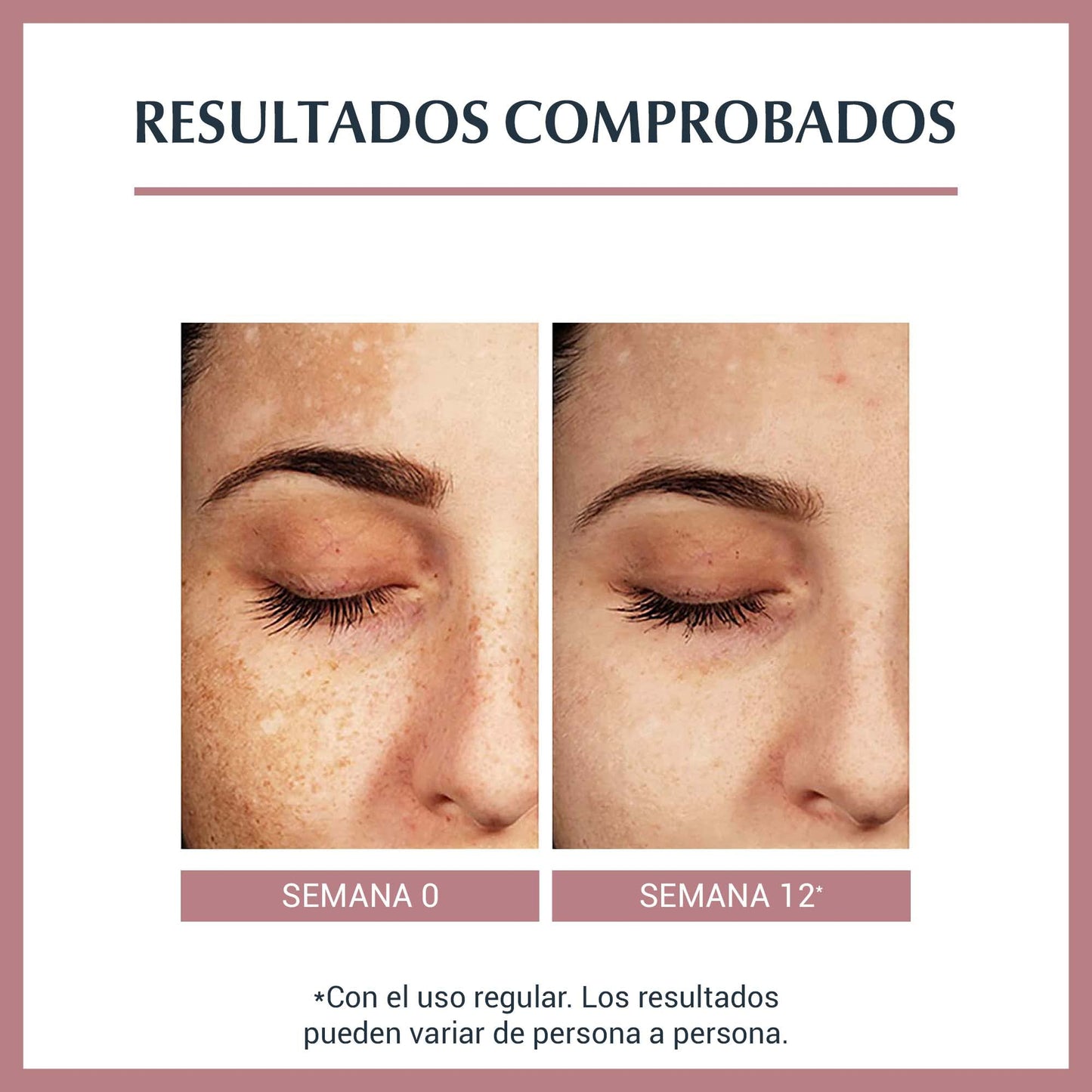 Eucerin Lápiz corrector anti manchas Anti Pigment Spot Corrector, 5ml + Protector solar facial anti manchas FPS 50+ Anti Pigment Sun, 50ml