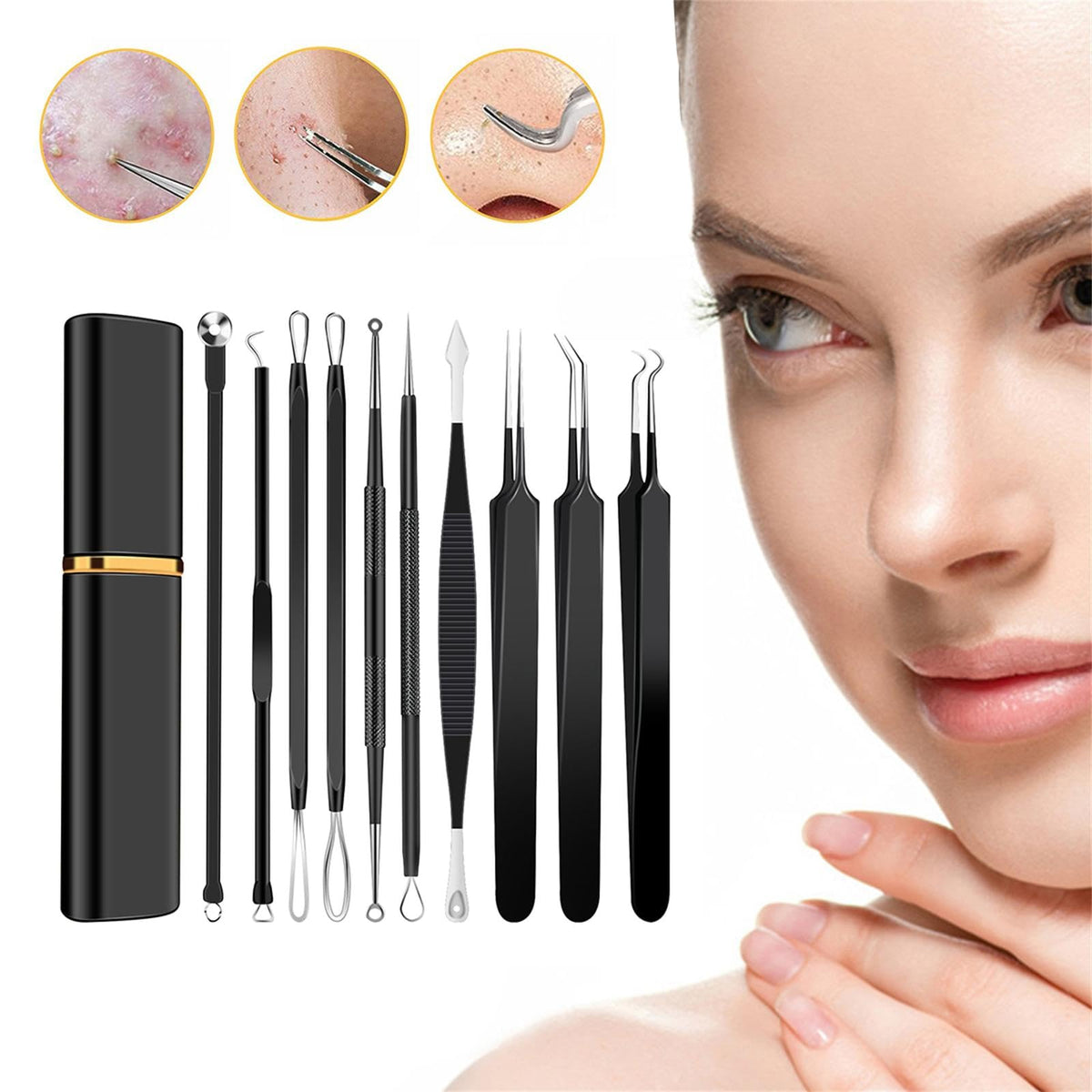Kit de herramientas de extracción de espinillas, de acero inoxidable, extractor de comedones, para frente, nariz, ligera, con funda de metal para viajes, uso doméstico
