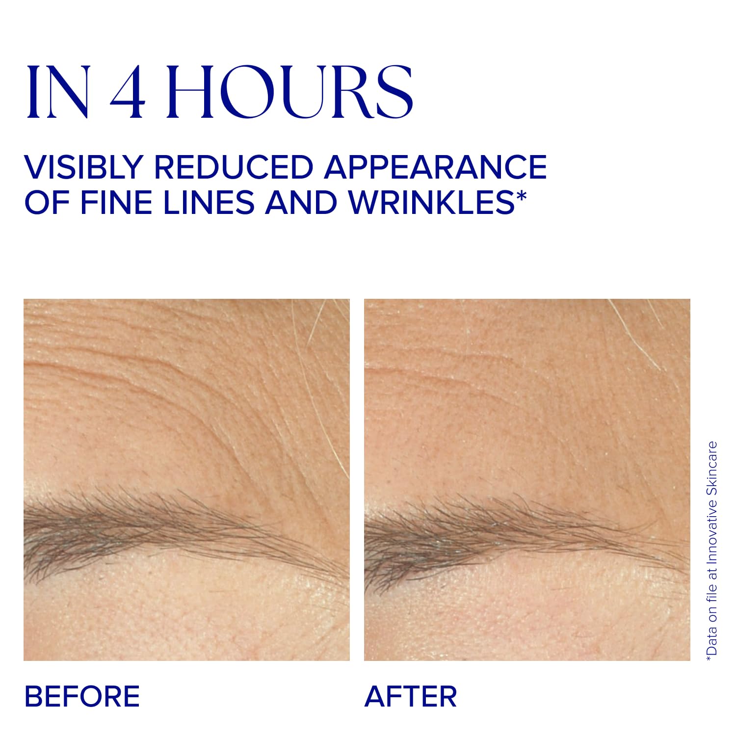 iS CLINICAL Youth Complex, 1 Oz