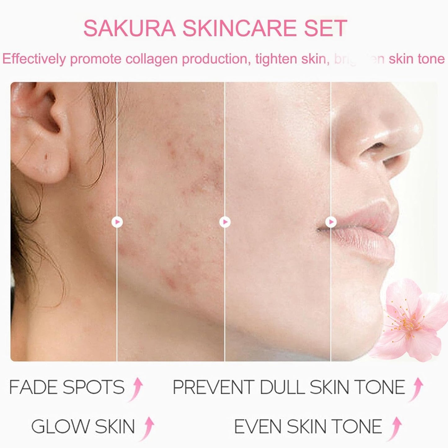 LAIKME- Kit de cuidado de la piel Sakura Skin Care Set Facial Kit, cuidado de la piel con flores de cerezo para adolescentes, juego de regalo completo para el cuidado de la piel Cre
