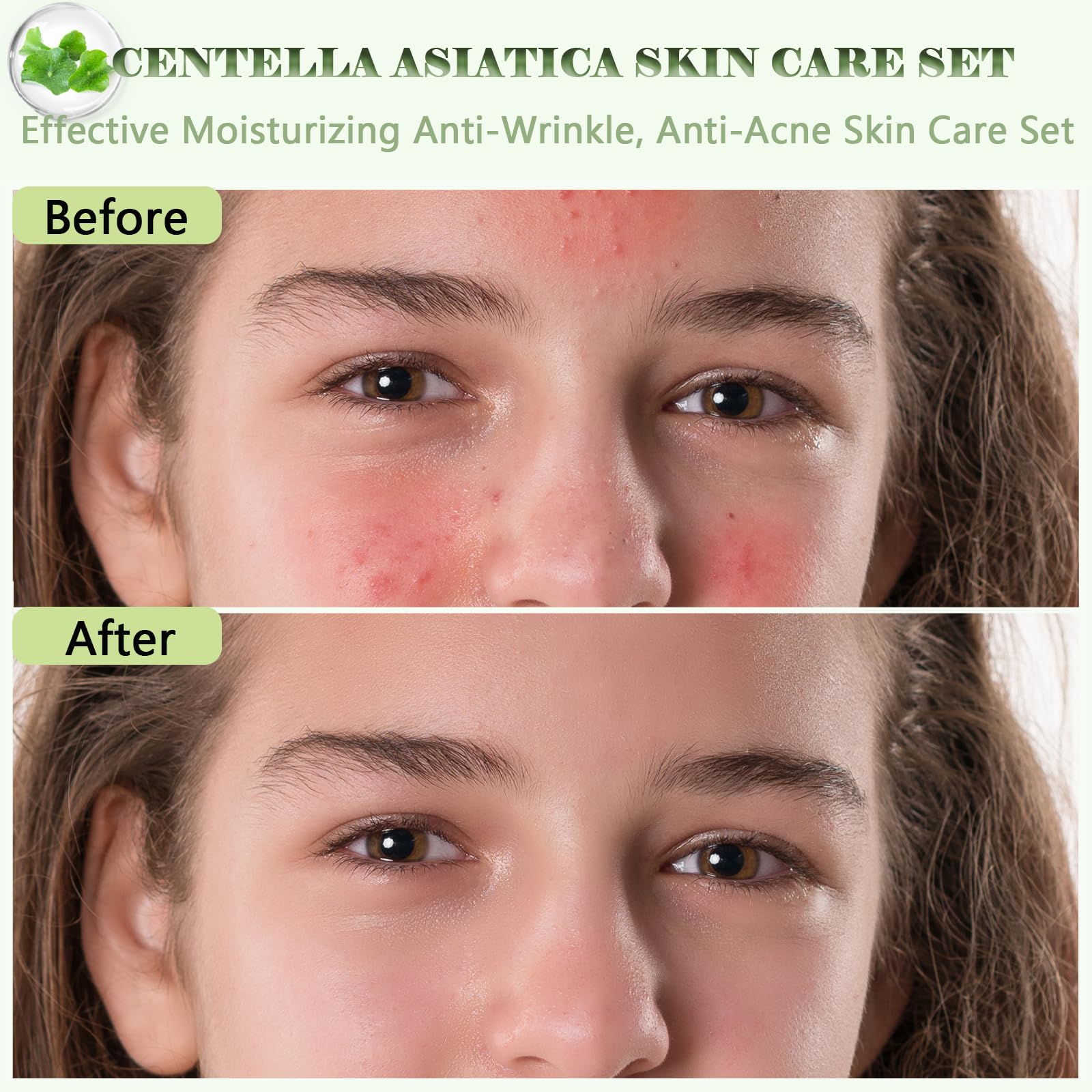 Set de regalo para el cuidado de la piel con Centella Asiatica para mujeres, set para el cuidado de la piel para hidratar, reparar y limpiar la piel, con suero, tónico, limpiador facial, crema para