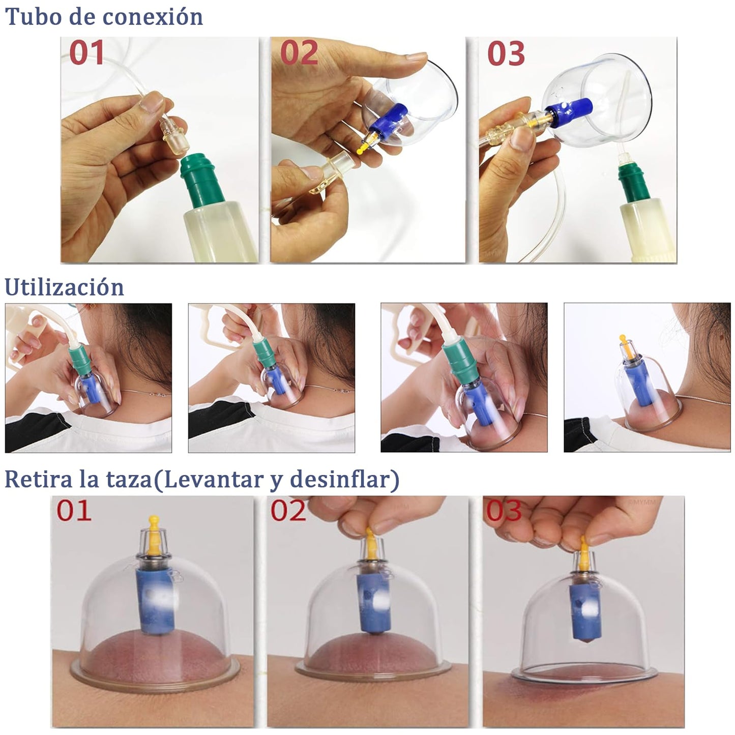 Juego de terapia de ventosas, juego de ventosas de 32 piezas, kit de ventosas profesional con tabla Gua Sha y ventosa de aceite Gua Sha, ventosa con bomba para aliviar la celulitis
