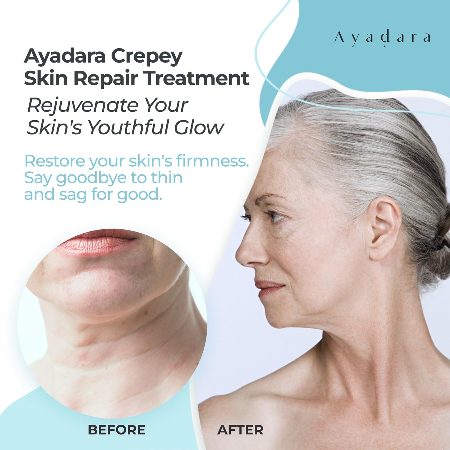 Ayadara Crepey Tratamiento reparador de la piel para brazos y piernas, crema reafirmante de ácido hialurónico para el cuello, crema antiarrugas para la cara, 8 onzas líquidas (237 ml)