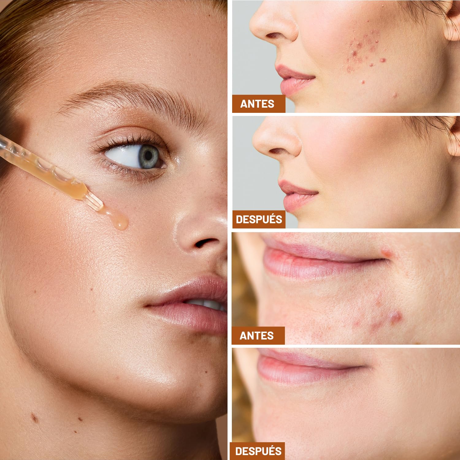 Suero Facial Vitamina C Carvenchy - Hidratación Profunda Antienvejecimiento - 2 Piezas - Suero Antiarrugas para Piel Radiante y Humectada.