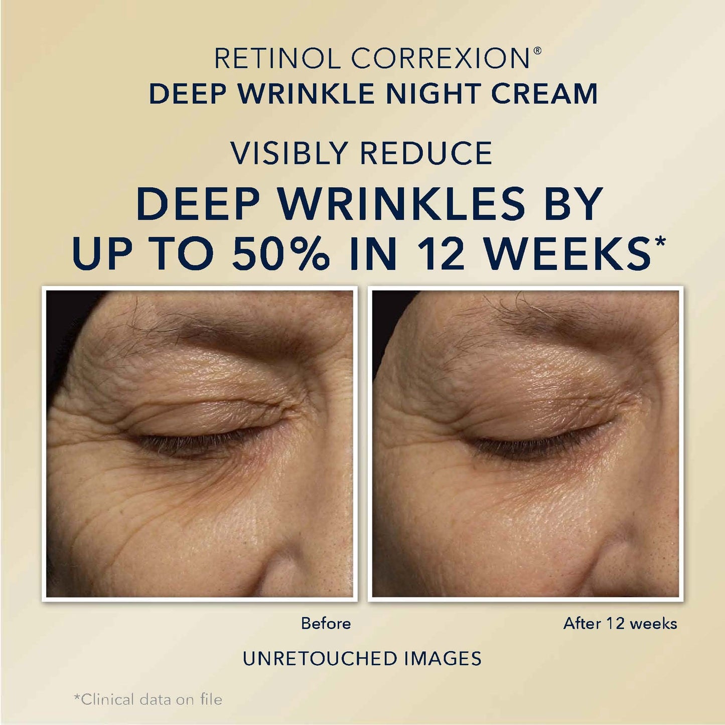 RoC Retinol Correxion Deep Wrinkle Repair Pack