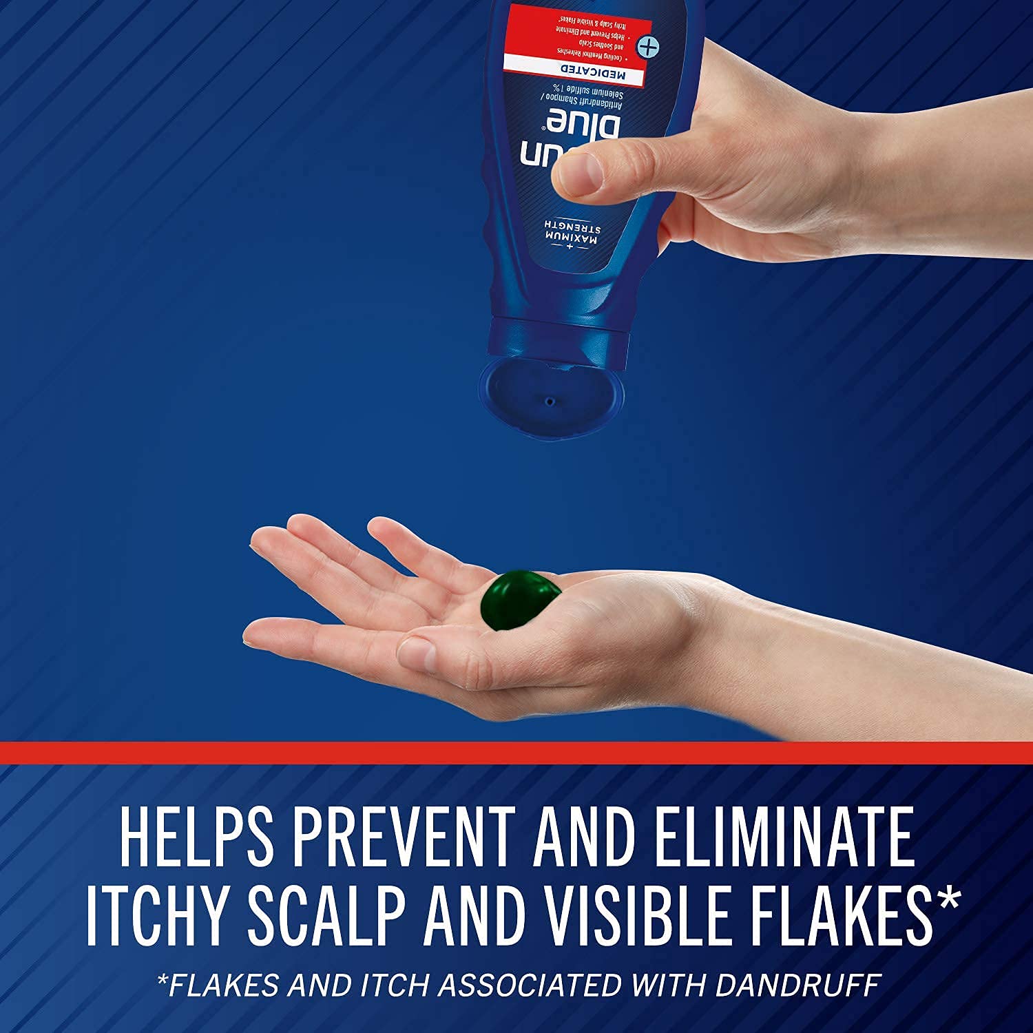 Selsun Blue Medicated Shampoo 11 ounce