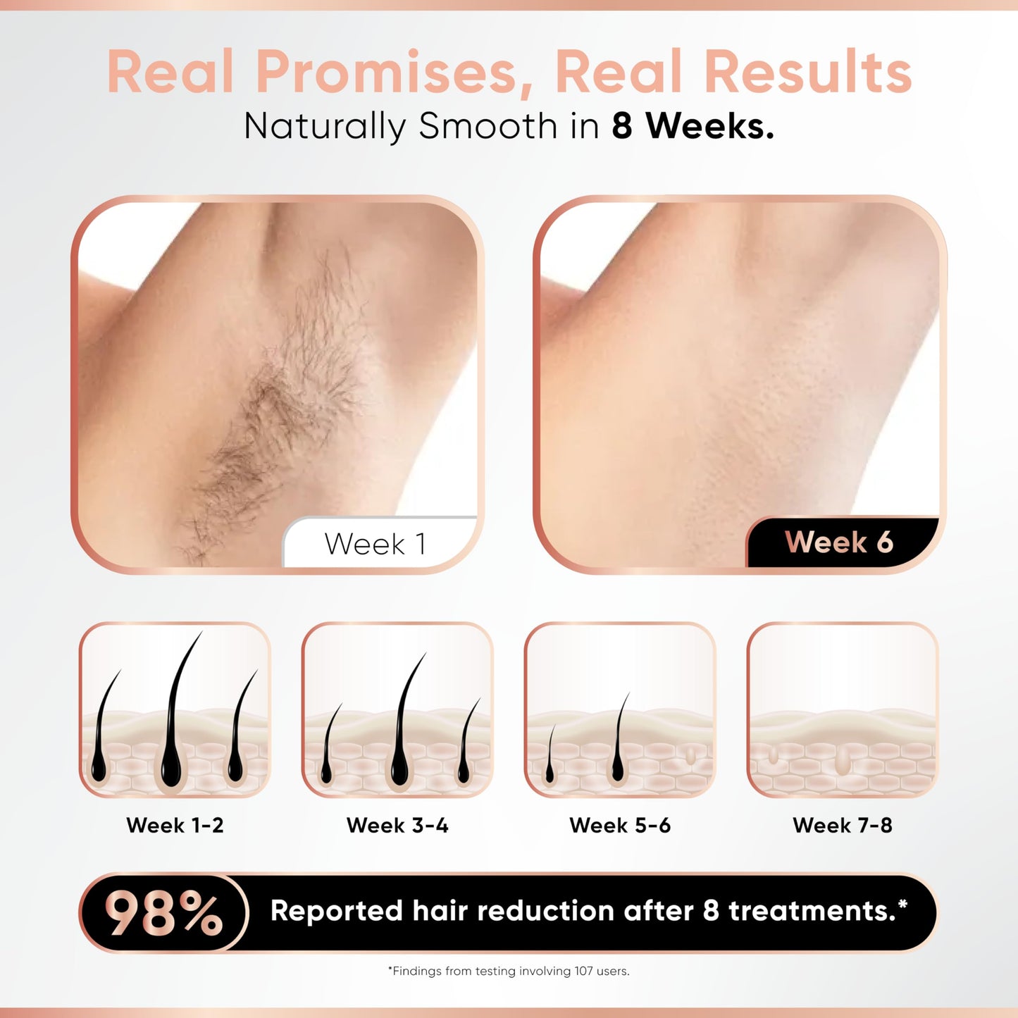 Depiladora Sensilight Mini Bronce para Mujer