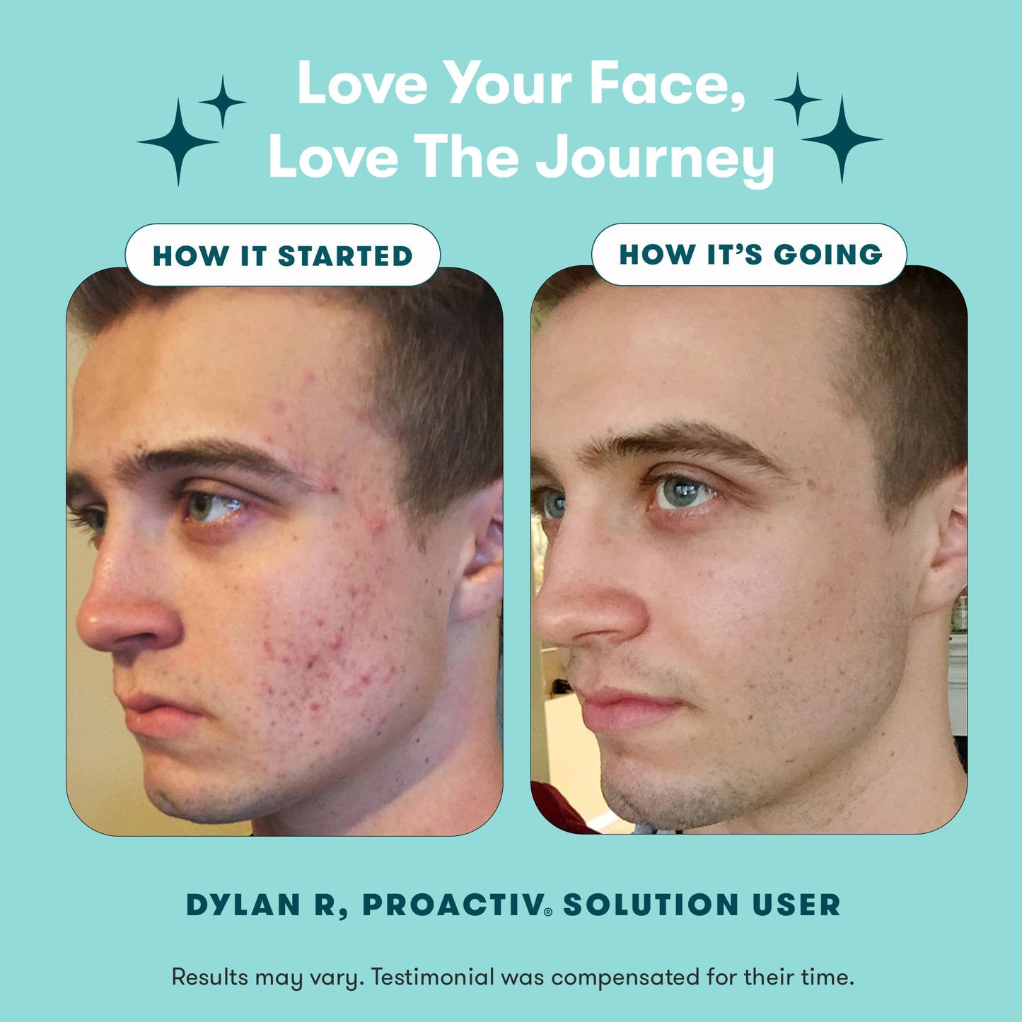 Kit de Inicio Sistema de Tratamiento para Acné Proactiv 3 Step