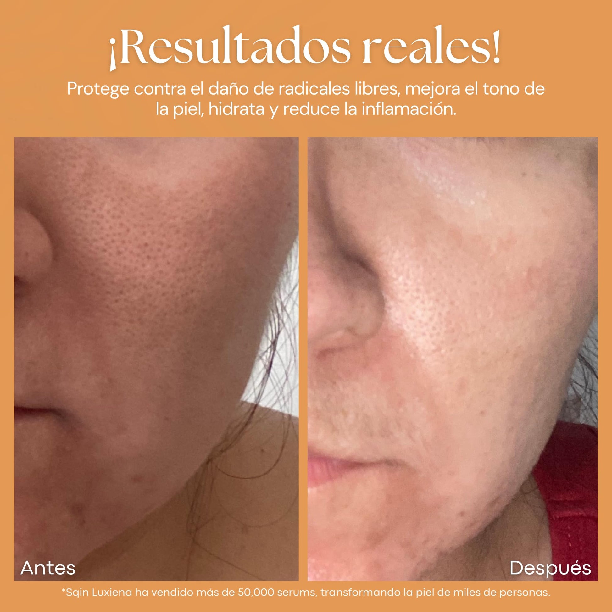 Sqin Luxiena Korean Serum de Vitamina C 2% y Ácido Hialurónico Facial. Aclara la Piel, Antimanchas facial + Antiarrugas + Antioxidante, Suero Facial de Día Vitamina C y Vitamina E, Skincare Coreano Vegano 32ml.