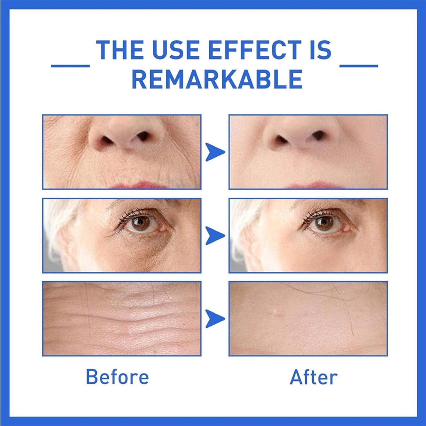 DQQSLQUL Botox Face Serum, Suero Facial Antienvejecimiento con Refuerzo de Colágeno, Botox Facial Instantáneo Tensor en una Botella, Reduce las Arrugas y Rellena la Piel,3PCS