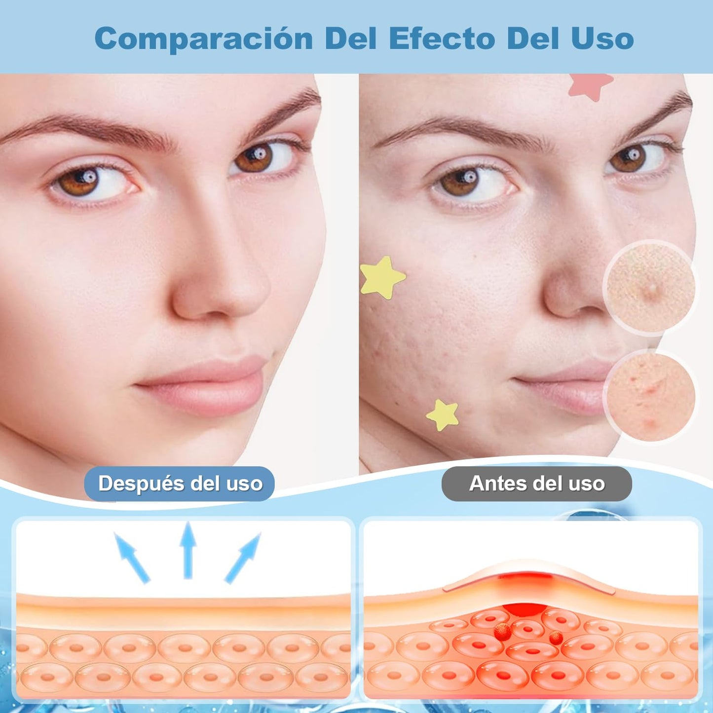 Parches Antiacné Estrella – 200 Hidrocoloides – Verde Actualizado