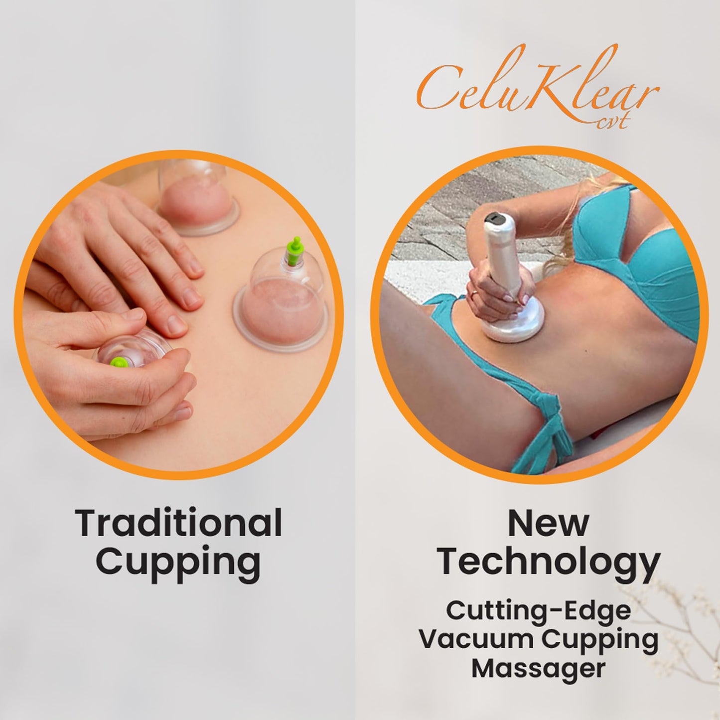 Nuflair Masajeador Eléctrico De Ventosas Celuklear Cvt 3 En 1: Máquina De Ventosas Para Celulitis, Masaje De Tejido Profundo Y Drenaje Linfático. Succión Ajustable Que Favorece La Circulación Y La Sal