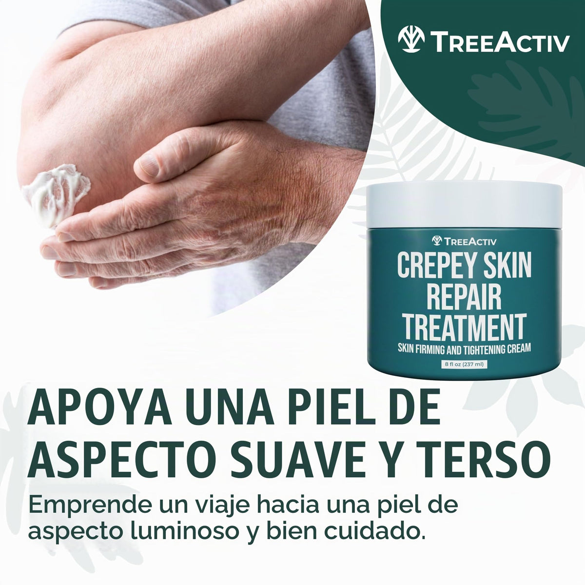 TreeActiv Crepey Skin Repair Treatment | Anti-Aging | Anti-Wrinkle | Organic Ingredients for Face, Neck, Chest, Legs & Arms | Hyaluronic Acid, Alpha Hydroxy Fruit Acids, Honey, Shea, Castor