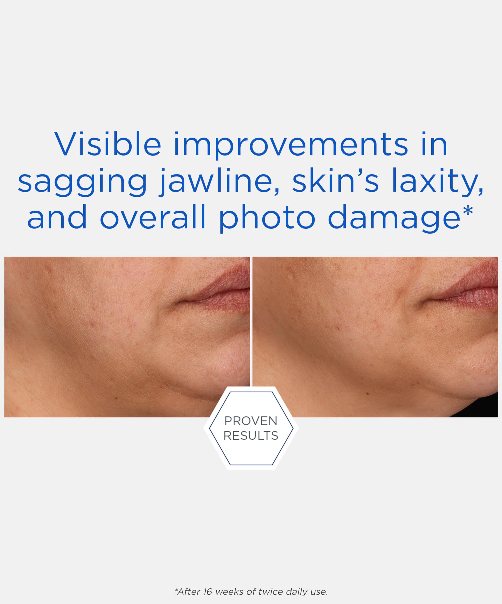 NEOSTRATA Crema escultora de rebote, hidratante de elevación multiacción, con ácido glicólico, péptidos y mezcla AHA/PHA, hidratante, no comedogénico, 1.7 onzas